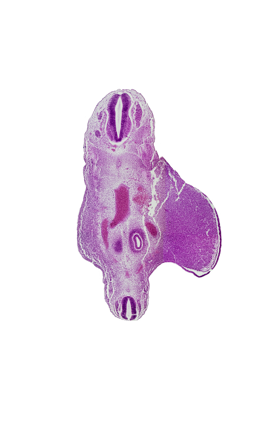 S-4 spinal ganglion, T-12 spinal ganglion, aorta, artifact fracture(s), caudal edge of metanephric cap, dermatomyotome, junction of aorta and right common iliac artery, lower limb, notochord, pelvis of metanephric diverticulum, spinal cord