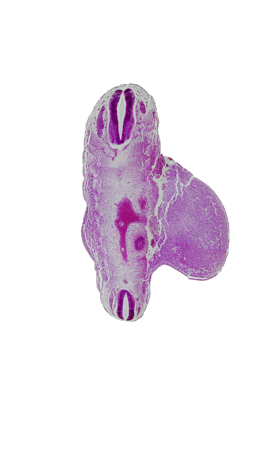 S-4 spinal ganglion, aorta, caudal edge of T-12 spinal ganglion, edge of metanephric cap, lower limb, median sacral artery, mesenchyme, notochord, spinal cord