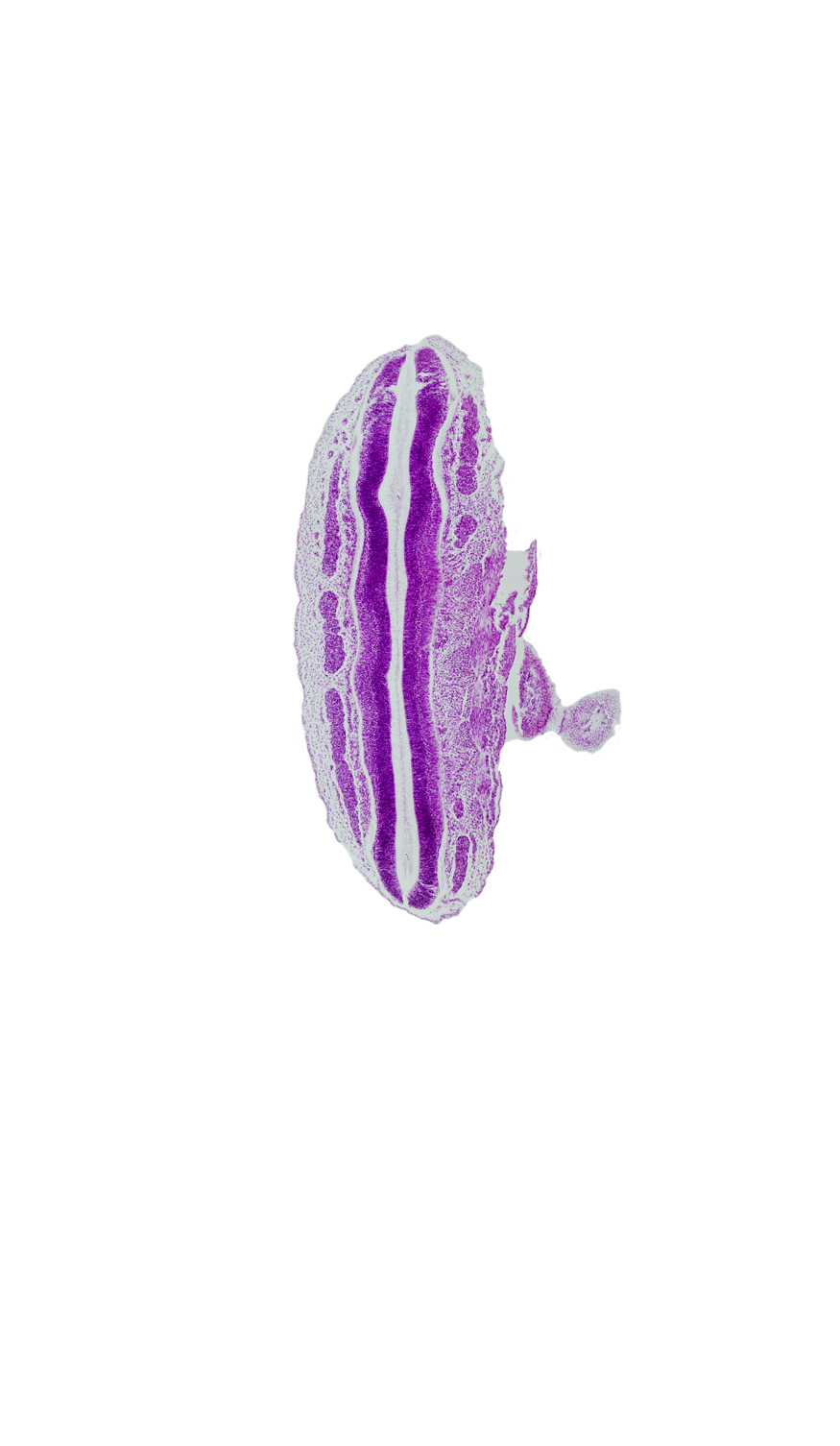 L-2 spinal ganglion, L-3 spinal ganglion, S-2 spinal ganglion, caudal edge of lower limb, central canal