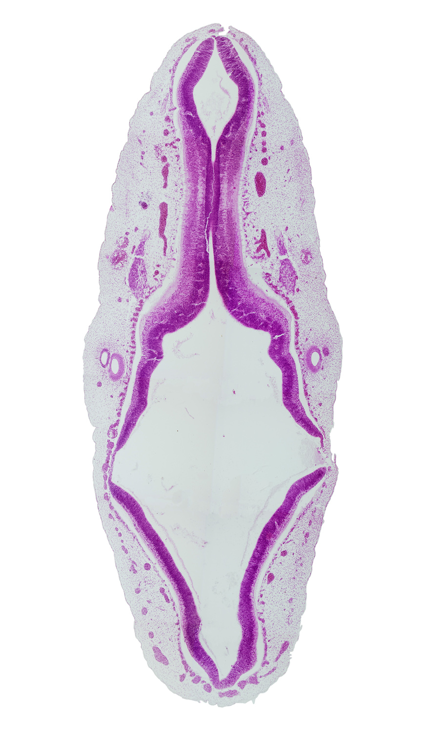 accessory nerve (CN XI), alar plate of metencephalon, alar plate of myelencephalon, alar plate of rhombencephalon, anterior dural venous plexus, caudal edge of roof plate of rhombencephalon, endolymphatic duct, junction of mesencoel and rhombencoel (fourth ventricle), metencephalic arteries, myelencephalic artery, posterior dural venous plexus, rhombencoel (fourth ventricle), roof plate of rhombencephalon, spinal accessory nerve (CN XI), sulcus limitans, vagus nerve (CN X), vascular plexus, vestibular part of otic vesicle