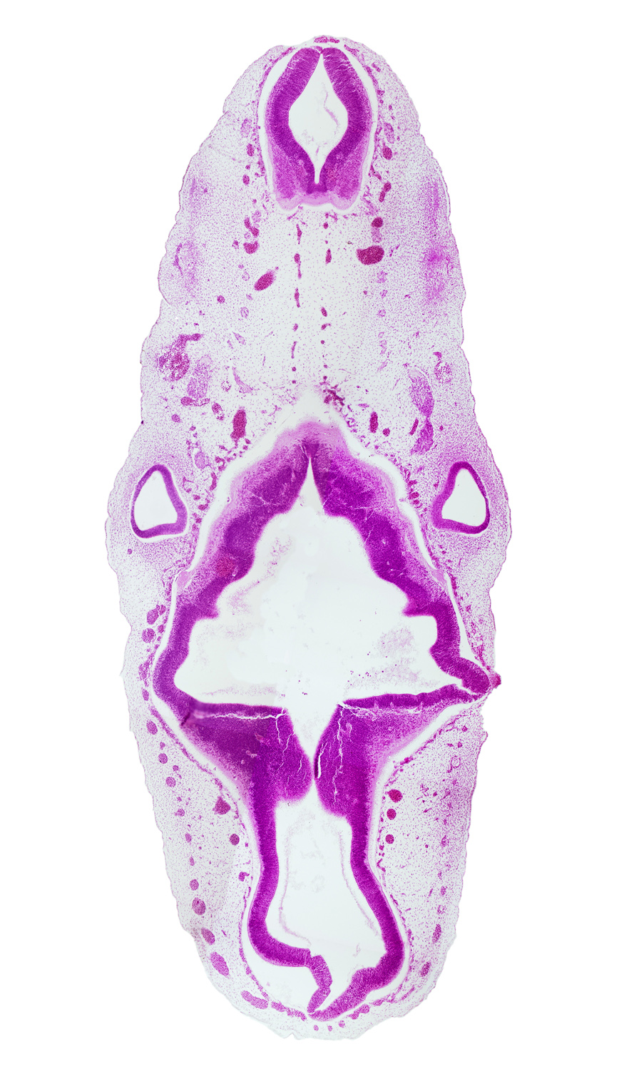accessory nerve (CN XI), anterior dural venous plexus, basal plate, caudal part of rhombencephalon, isthmus of rhombencephalon, mesencephalon (M2) (partly collapsed), mesencoel (cerebral aqueduct), middle dural venous plexus, myelencephalic artery, posterior dural venous plexus, rhombencoel (fourth ventricle), rhombomere 1, rhombomere 2, rhombomere 3, rhombomere 4, rhombomere 5, root of hypoglossal nerve (CN XII), sulcus limitans, superior ganglion of glossopharyngeal nerve (CN IX), tectum, tegmentum, vagus nerve (CN X), vascular plexus