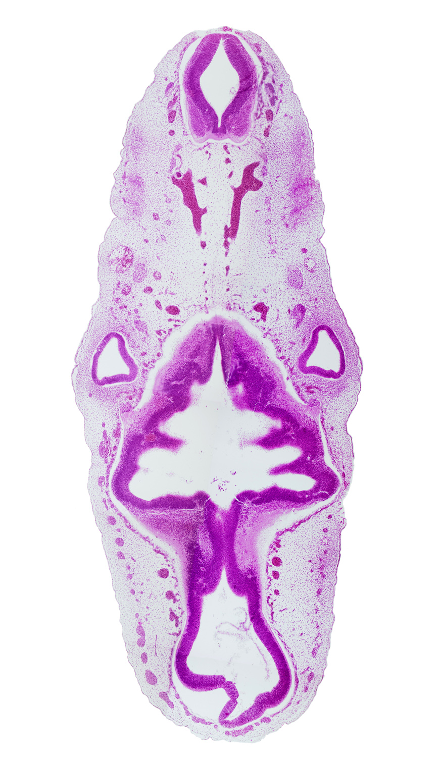 alar plate(s), basal plate, floor plate, glossopharyngeal nerve (CN IX), intermediate zone, isthmus of rhombencephalon, mesencoel (cerebral aqueduct), middle dural venous plexus, posterior dural venous plexus, rhombencoel (fourth ventricle), rhombomere 1, rhombomere 2, rhombomere 3, rhombomere 5, roof plate, root of hypoglossal nerve (CN XII), sulcus limitans, tectum, tegmentum, vagus nerve (CN X), ventricular zone, vertebral artery, vestibular part of otic vesicle, vestibulocochlear nerve (CN VIII)