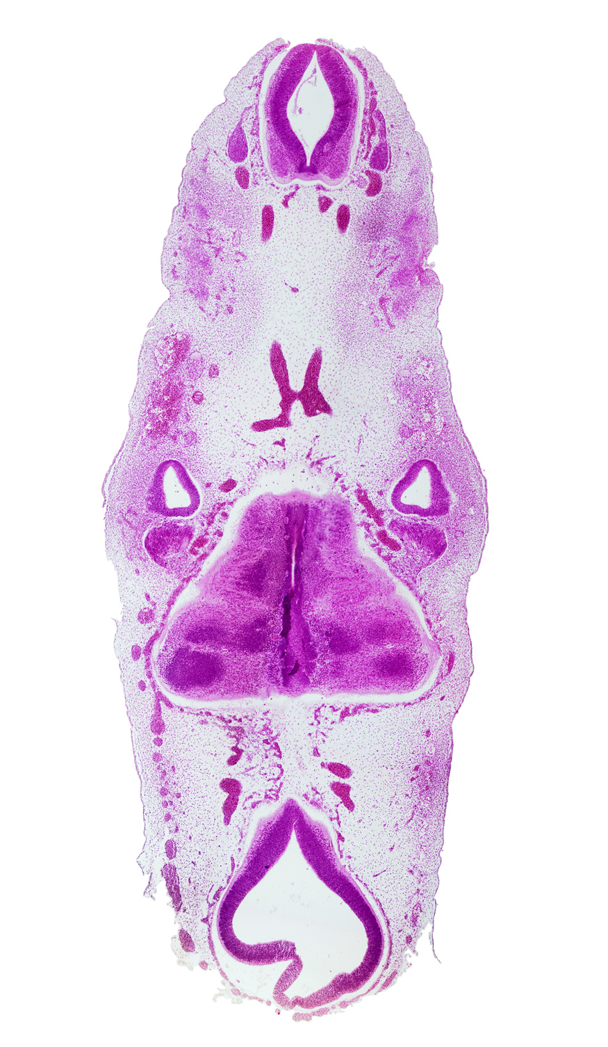 C-1 spinal ganglion, abducens nerve area (CN VI), anterior spinal artery, caudal edge of rhombencoel (fourth ventricle), cervical part of spinal cord, glossopharyngeal nerve (CN IX), hypoglossal nerve (CN XII), intermediate zone, marginal zone, mesencoel (cerebral aqueduct), metencephalic arteries, stem of anterior inferior cerebellar artery, stem of posterior dural venous plexus, vagus nerve (CN X), ventricular zone, vertebral artery, vestibular part of otic vesicle, vestibulocochlear nerve (CN VIII)