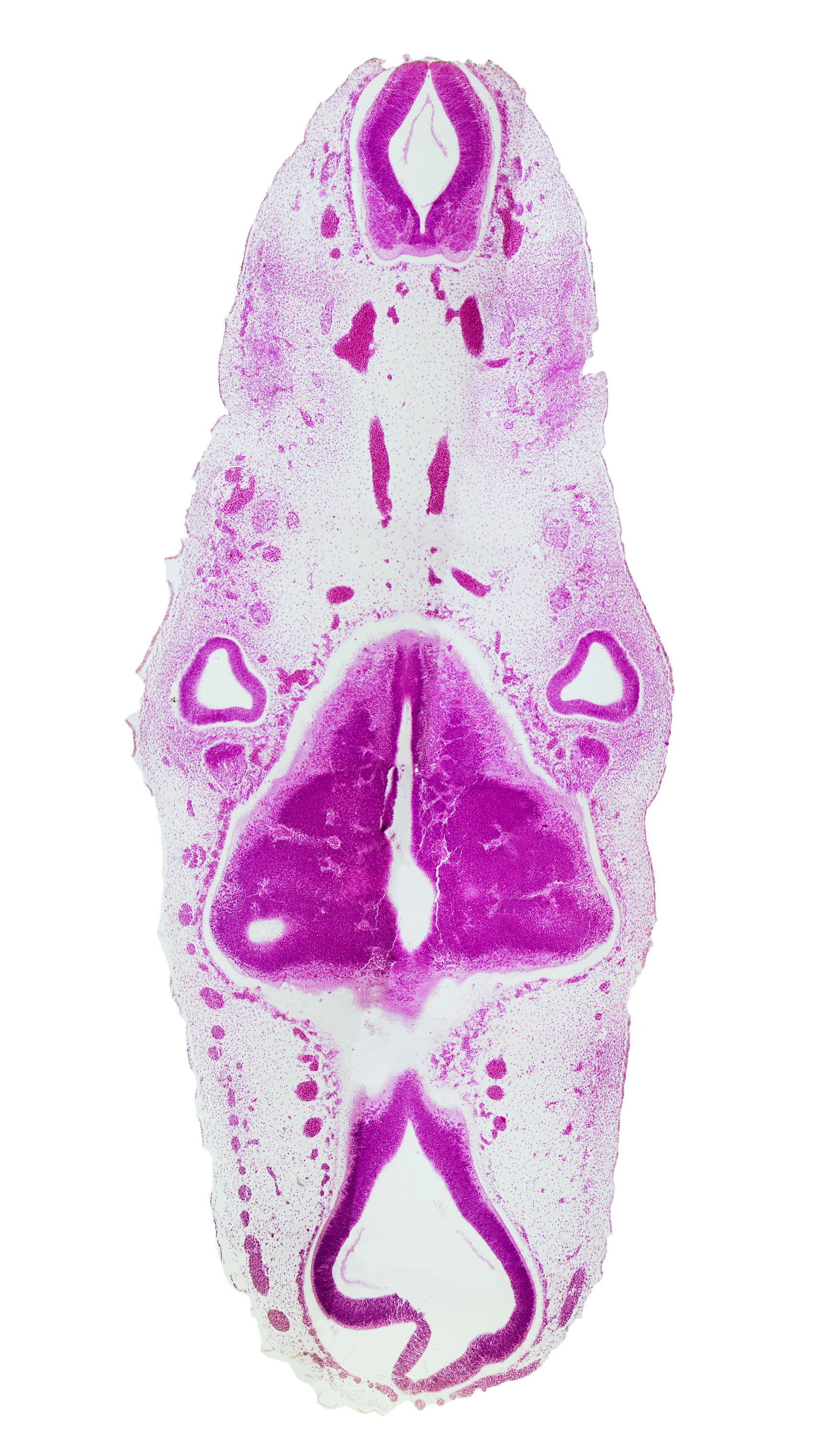 accessory nerve (CN XI), anterior dural venous plexus, caudal part of rhombencoel (fourth ventricle), glossopharyngeal nerve (CN IX), intermediate zone, junction of brain and spinal cord, marginal zone, mesencephalon (M2), mesencoel (cerebral aqueduct), metencephalic arteries, region of trochlear nerve (CN IV), rhombomere 2, rhombomere 3, root of hypoglossal nerve (CN XII), stem of posterior dural venous plexus, sulcus limitans, vagus nerve (CN X), ventricular zone, vertebral artery, vestibulocochlear ganglion (CN VIII)