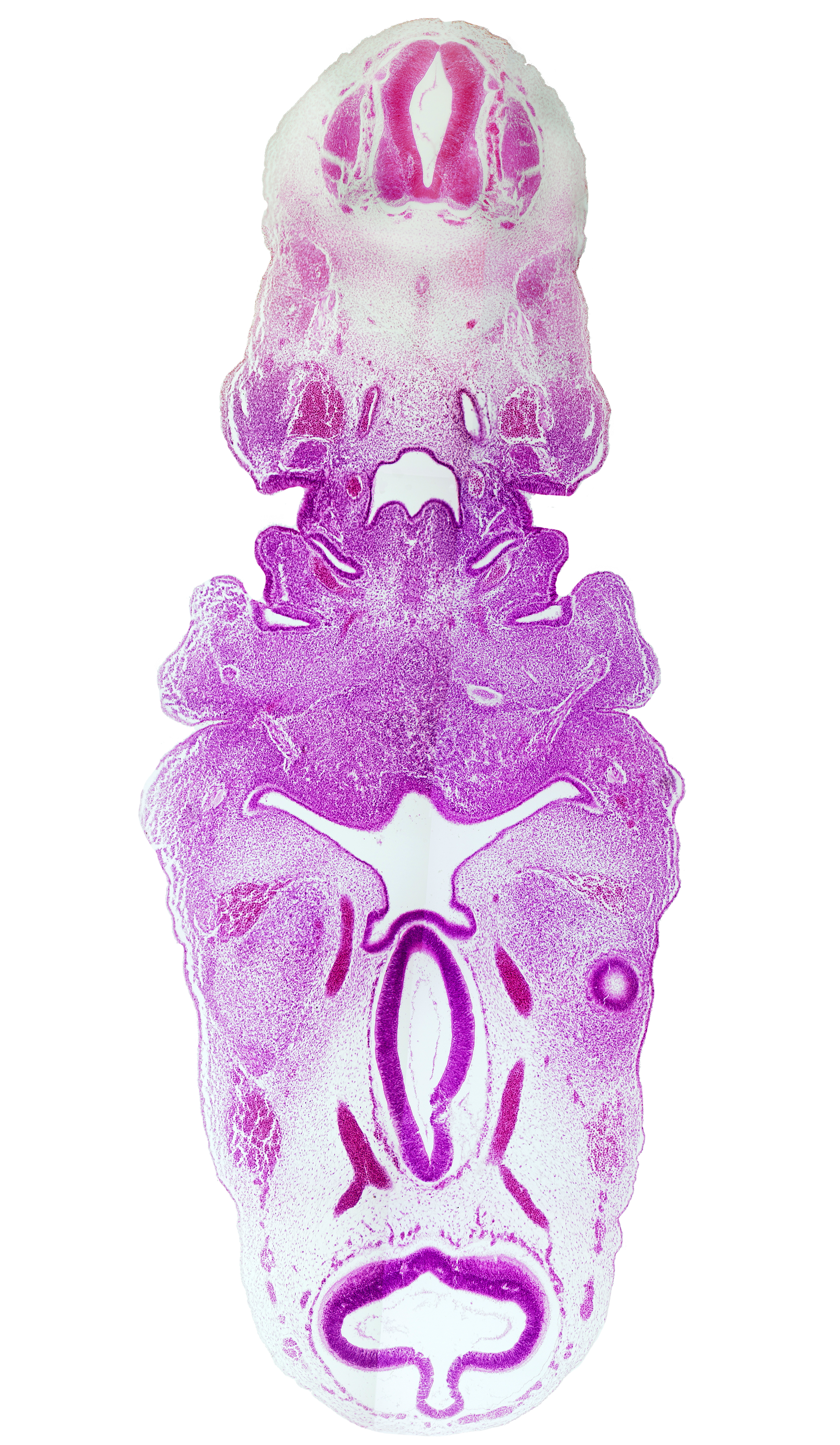 C-3 spinal ganglion, adenohypophysial pouch, aortic arch 3, aortic arch 4 (aortic arch), cephalic edge of optic cup, cervical sinus, chorda tympani nerve, collapsed tectum of mesencephalon (M1), dorsal aorta, facial nerve (CN VII), hypothalamic sulcus, internal carotid artery, lateral lingual swelling of tongue, mandibular nerve (CN V₃), mandibular prominence of pharyngeal arch 1, maxillary nerve (CN V₂), pharyngeal arch 3, pharyngeal arch 4, pharyngeal pouch 2, pharyngeal pouch 3, posterior communicating artery, primordial maxillary vein, region of mesencephalic (cephalic) flexure, stem of anterior dural venous plexus, thyroglossal duct