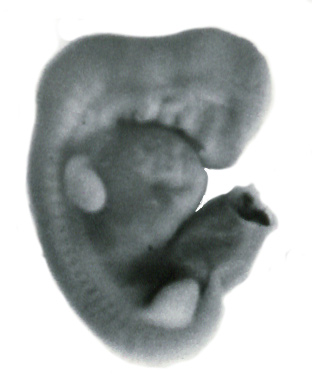 Right lateral view of the embryo prior to sectioning