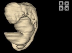 Embryo