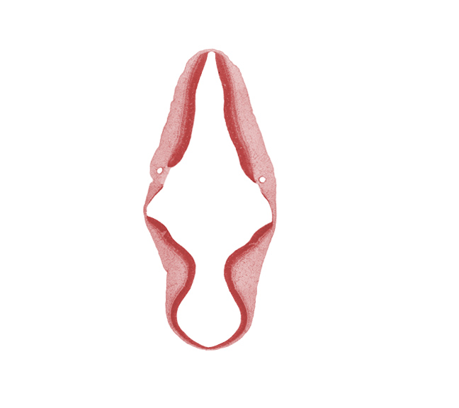 alar plate(s), artifact separation(s), basal plate, cephalic edge of sulcus limitans, isthmus of rhombencephalon, mesencephalon (M2), mesencoel (cerebral aqueduct), metencephalon, myelencephalon, rhombencoel (fourth ventricle), roof plate, trochlear nerve (CN IV)