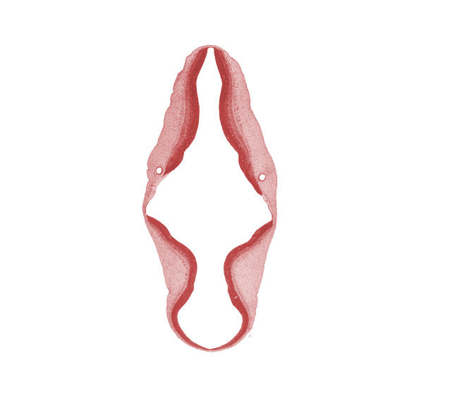 alar plate(s), artifact separation(s), basal plate, isthmus of rhombencephalon, metencephalon, roof plate, sulcus limitans, tectum, tegmentum