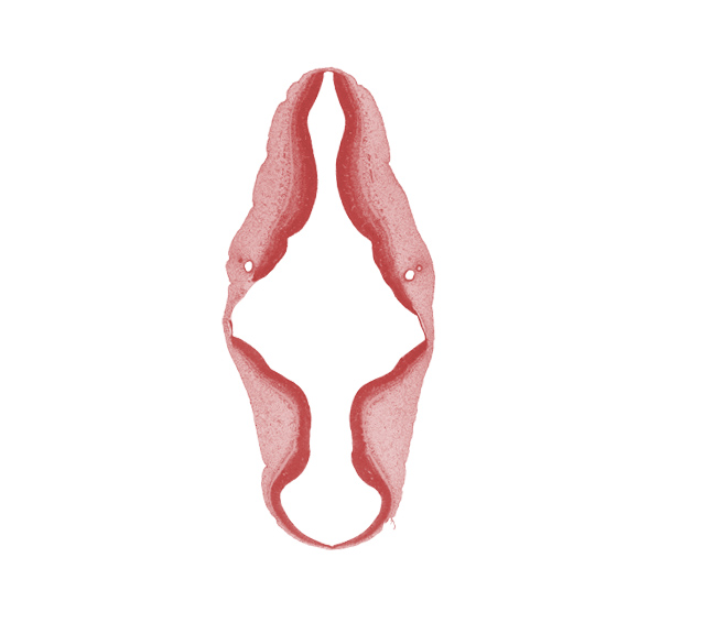 alar plate(s), artifact separation(s), endolymphatic duct, intermediate zone, marginal zone, mesencephalon (M2), metencephalon, myelencephalon, roof plate, sulcus limitans, trochlear nerve (CN IV), ventricular zone, vestibular part of otic vesicle