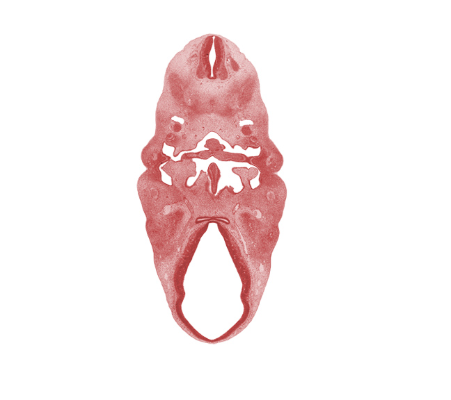 C-2 spinal ganglion, adenohypophysial pouch, anterior dural venous plexus, dorsal root(s), dorsal sulcus, facial nerve (CN VII), glossopharyngeal nerve (CN IX), hypopharyngeal eminence of tongue, inferior ganglion of vagus nerve (CN X), intermediate zone, internal carotid artery, junction of internal carotid and posterior communicating arteries, mandibular nerve (CN V₃), marginal zone, middle sulcus, myotome, neurohypophyseal bud, pharyngeal groove 1, pharynx, precardinal vein, sclerotome, spinal accessory nerve (CN XI), tuberculum impar of tongue, ventral (hypothalamic) sulcus, ventricular zone