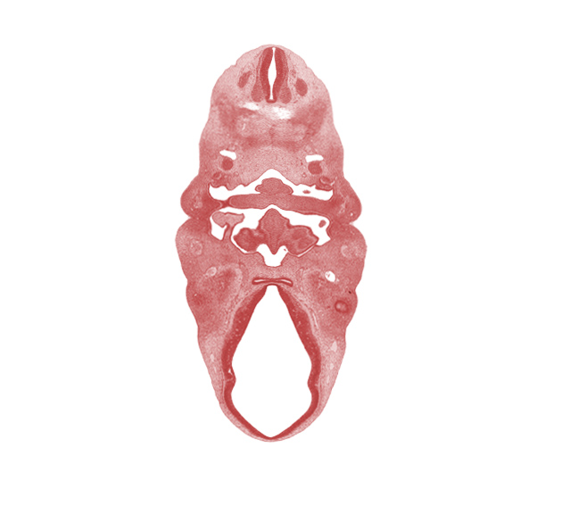 C-2 spinal ganglion, adenohypophysial pouch, central canal, copula of tongue, diencephalon, dorsal thalamus, edge of optic cup, epiglottis, facial nerve (CN VII), foramen cecum of tongue, glossopharyngeal nerve (CN IX), hypoglossal nerve (CN XII), hypothalamus, inferior ganglion of vagus nerve (CN X), lateral lingual swelling of tongue, mandibular nerve (CN V₃), maxillary vein, neurohypophyseal bud, notochord, oronasal cavity, pharyngeal groove 1, pharyngeal pouch 2, pharynx, primordium of lateral palatine process, third ventricle, tuberculum impar of tongue, ventral thalamus