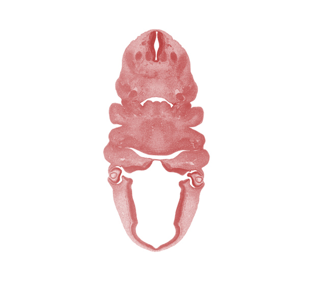 C-2 spinal ganglion, alar plate(s), aortic arch 3, basal plate, carotid duct, corneal epithelium, deep lens epithelium, dorsal sulcus, dorsal thalamus, epithalamus, floor plate, hyaloid vessels in optic cup cavity, hypoglossal nerve (CN XII), internal carotid artery, intraretinal space (optic vesicle cavity), laryngeal pharynx, mandibular nerve (CN V₃), mandibular prominence of pharyngeal arch 1, maxillary prominence of pharyngeal arch 1, maxillary vein, mesenchymal condensation of epiglottis, optic chiasma (chiasmatic plate), optic stalk lumen (CN II), pharyngeal arch 3, resorbing thyroglossal duct, roof plate, sulcus limitans, ventral thalamus, vertebral artery