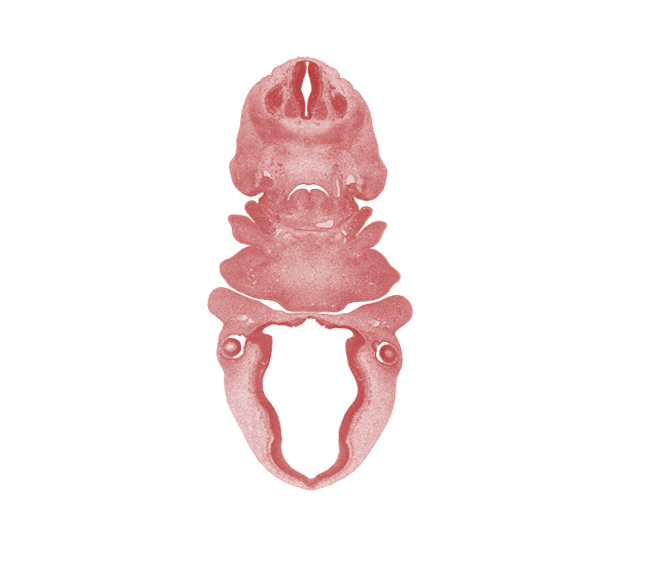 C-3 spinal ganglion, aortic arch 4, bilobed thyroid gland, central canal, cervical fold, cervical sinus, diencephalon, edge of cerebral vesicle(s), edge of optic stalk (CN II), epithalamus, horn of aortic sac, hypoglossal nerve (CN XII), intraretinal space (optic vesicle cavity), laryngeal condensation, lateral lingual swelling of tongue, lateral part of thyroid gland, myotome, optic chiasma (chiasmatic plate), optic cup cavity, oronasal cavity, pineal bud, precardinal vein, primordial meninx, spinal accessory nerve (CN XI), sternocleidomastoid / trapezius premuscle mass, third ventricle