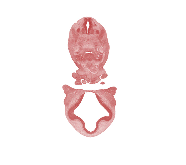 C-3 / C-4 interganglion region, aortic arch 6, caudal edge of C-3 spinal ganglion, caudal edge of mandibular prominence of pharyngeal arch 1, cephalic edge of C-4 spinal ganglion, cervical plexus, diencephalon, dorsal aorta, edge of cerebral vesicle (telencephalon), edge of oronasal cavity, hypoglossal nerve (CN XII), junction of aortic sac and ascending aorta, junction of diencephalon and telencephalon, junction of maxillary and medial nasal prominences, lamina terminalis, maxillary venous plexus, precardinal vein, spinal accessory nerve (CN XI), sympathetic trunk, transition region, ultimopharyngeal pouch