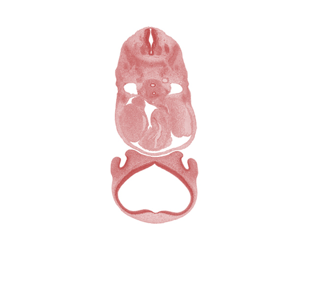 archipallium, caudal edge of C-4 spinal ganglion, central canal, cerebral vesicle (neopallium), cervical plexus, esophagus, infrahyoid premuscle mass, intermediate zone, left atrium, marginal zone, naris, nasal disc (olfactory placode), nasal sac, paleopallium, pericardial cavity, primordial meninx, right atrium, sinus venosus, sympathetic trunk, trachea, ventricular zone