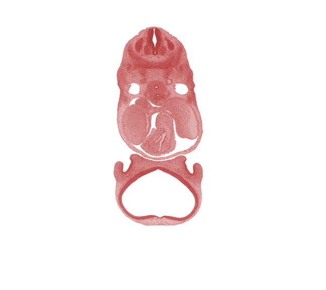 C-5 spinal ganglion, anterior spinal artery, aortic vestibule of left ventricle, archipallium, cerebral vesicle (neopallium), dorsal fasciculus, infrahyoid premuscle mass, infundibulum of right ventricle, left atrium, naris, nasal disc (olfactory placode), nasal sac, nasal septum region, paleopallium, pericardial cavity, precardinal vein, right atrium, semilunar valve region, sinus venosus, surface ectoderm