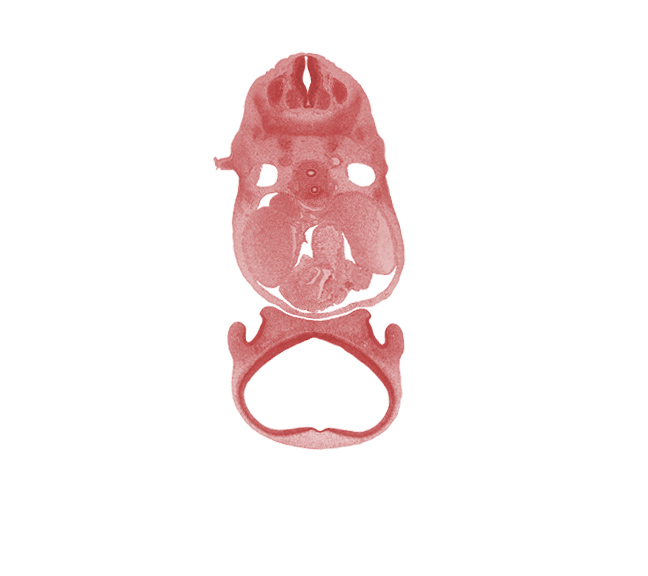 C-5 spinal ganglion, aortic vestibule of left ventricle, cephalic edge of upper limb, cornu Ammonis, dense caudal part of sclerotome, dorsal aorta, esophagus, gyrus dentatus, head mesenchyme, infundibulum of right ventricle, lateral nasal prominence, medial nasal prominence(s), nasal capsule, pericardial cavity, phrenic nerve, region of olfactory filia (CN I), sympathetic trunk, telencephalon medium, trachea, transverse sinus, tuberculum olfactorium, vagus nerve (CN X)