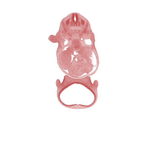 C-5 spinal ganglion, aortic vestibule of right ventricle, dorsal aorta, esophagus, heart prominence, infundibulum of right ventricle, lateral ventricle, left atrium, nasal disc (olfactory placode), phrenic nerve, precardinal vein, region of olfactory filia (CN I), right atrium, secondary interatrial septum (septum secundum), sinus venosus, sympathetic trunk, telencephalon medium, trachea