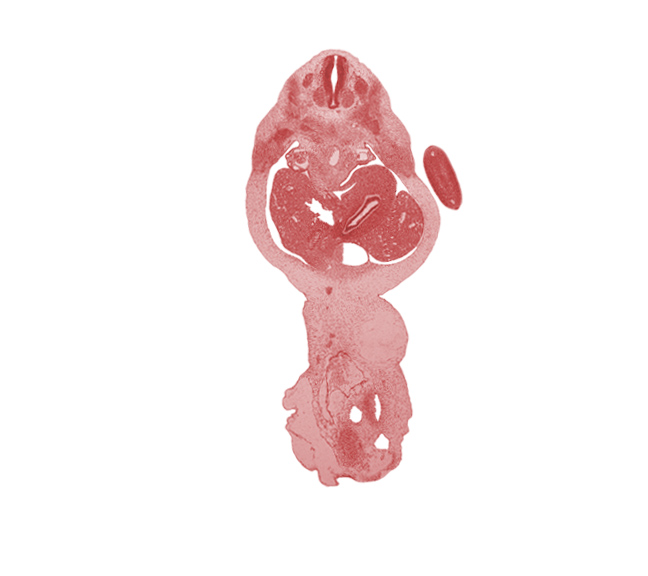 T-2 spinal ganglion, T-3 intercostal nerve, aorta, blastema of rib 3, cystic duct, dorsal mesogastrium, falciform ligament, hepatic portal vein, junction of ductus venosus and umbilical vein, junction of duodenum and stomach, left hepatic duct, left lobe of liver, lesser sac (omental bursa), postcardinal vein, right hepatic duct, right lobe of liver, spleen