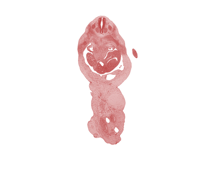 T-3 spinal ganglion, T-3 ventral root, amnion, aorta, blastema of rib 4, duodenum, edge of left lobe of liver, hand plate, mesonephric capsule, mucoid connective tissue, notochord, peritoneal cavity, right lobe of liver, umbilical vein