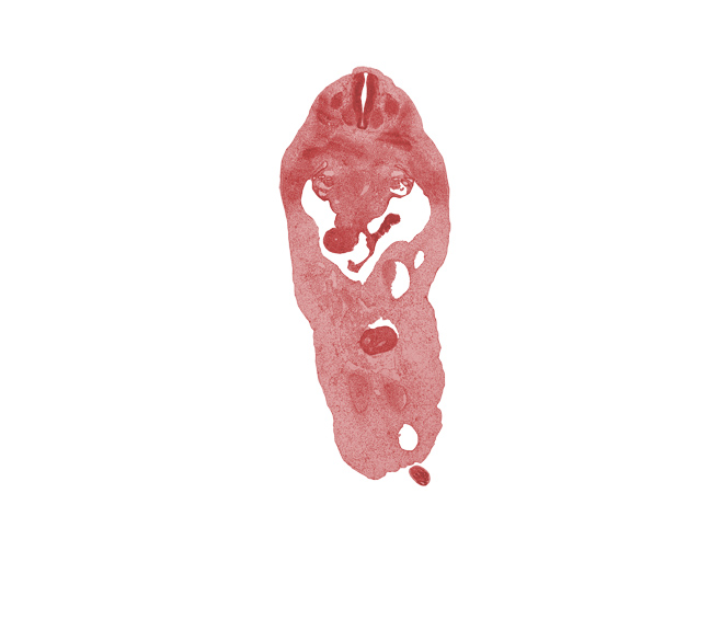 T-4 spinal ganglion, aorta, blastema of rib 5, caudal eminence, dorsal fasciculus, duodenum (endoderm), intermediate zone, marginal zone, mesenchymal condensation around hindgut, midpoint of herniated midgut, peritoneal cavity, postcardinal vein, subcardinal vein, superior mesenteric vein, umbilical coelom, umbilical cord, ventricular zone