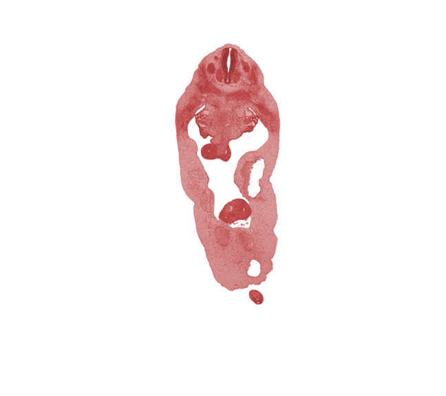 T-4 spinal ganglion, T-5 spinal nerve, aorta, blastema of rib 6, distal limb of herniated midgut, duodenum, gonadal ridge, peritoneal cavity, postcardinal vein, proximal limb of herniated midgut, subcardinal vein, superior mesenteric vein, sympathetic trunk, umbilical coelom, umbilical cord, umbilical vein