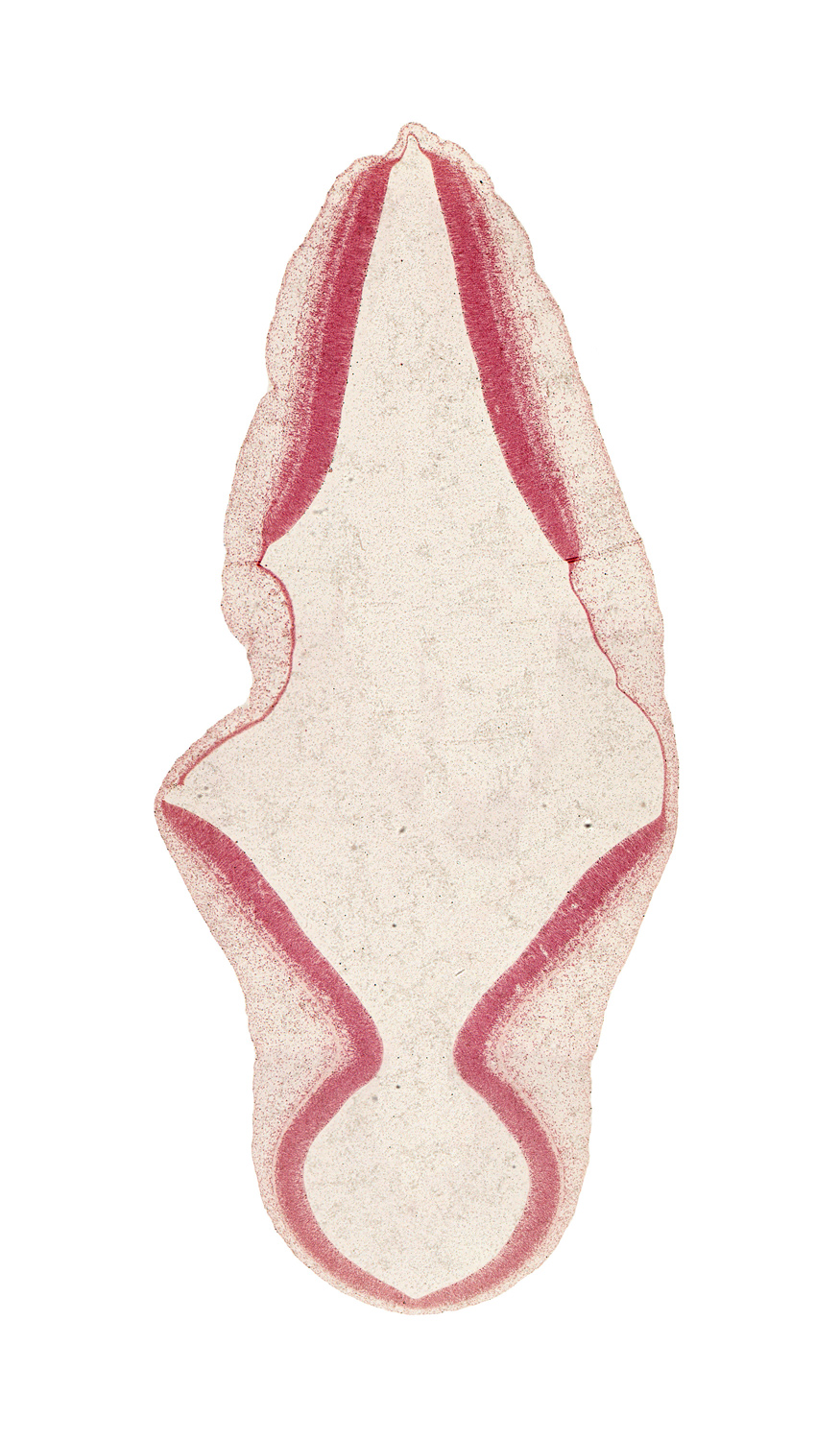 intermediate zone, isthmus of rhombencephalon, junction of mesencoel and rhombencoel (fourth ventricle), marginal zone, mesencephalon (M2), mesencoel (cerebral aqueduct), primordial meninx, rhombencoel (fourth ventricle), roof plate of myelencephalon, roof plate of rhombencephalon, ventricular zone