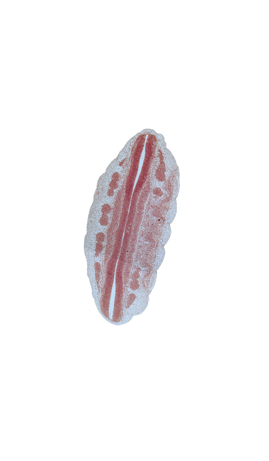 L-1 spinal ganglion, L-2 spinal ganglion, L-3 ventral root, L-4 ventral root, L-5 spinal ganglion, S-1 spinal ganglion, alar plate(s), basal plate, central canal, roof plate