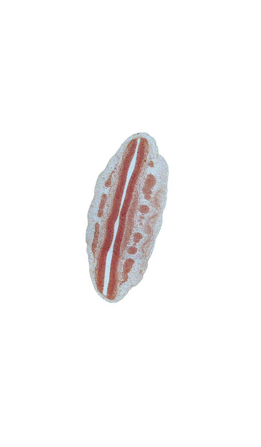 L-1 spinal ganglion, L-2 spinal ganglion, L-3 spinal ganglion, L-4 spinal ganglion, L-5 spinal ganglion, alar plate(s), dorsal root(s), primordial meninx