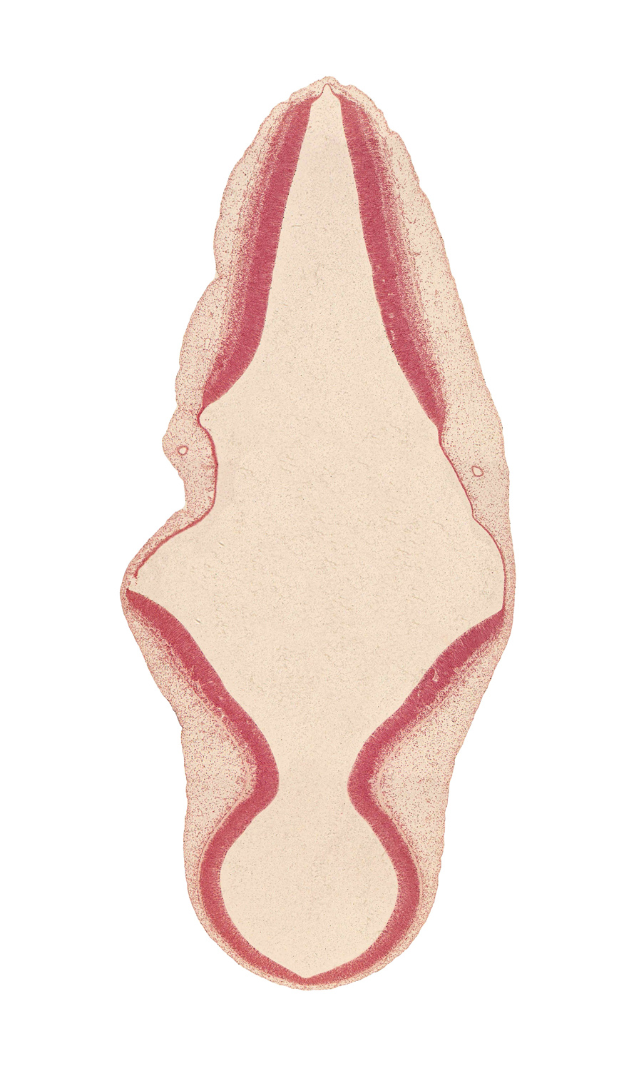 alar plate of myelencephalon, edge of endolymphatic duct, endolymphatic duct, head mesenchyme, isthmus of rhombencephalon, junction of mesencoel and rhombencoel (fourth ventricle), mesencephalon (M2), mesencoel (cerebral aqueduct), rhombencoel (fourth ventricle), roof plate of myelencephalon, roof plate of rhombencephalon