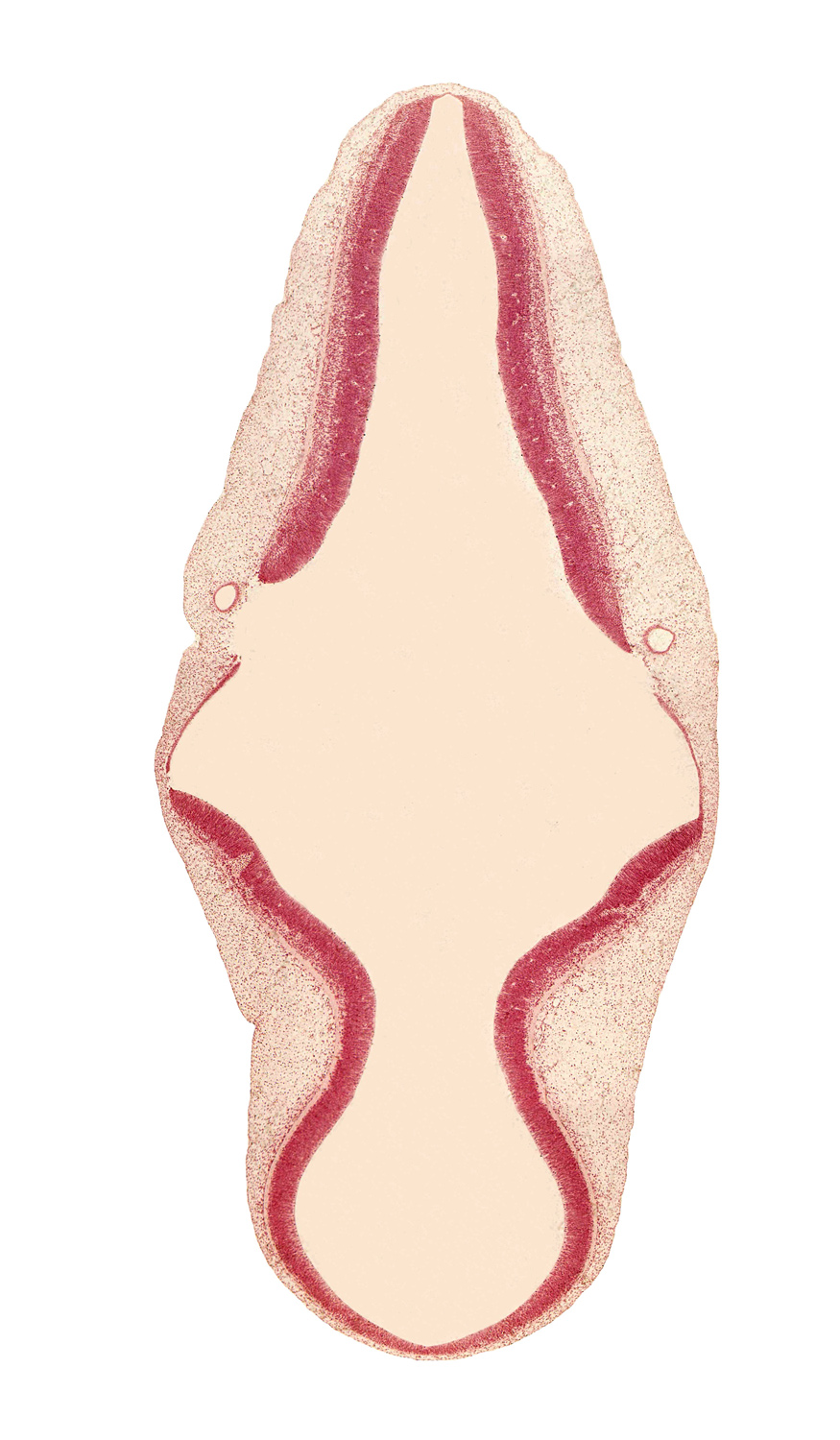 alar plate(s), artifact separation(s), basal plate, cephalic edge of sulcus limitans, isthmus of rhombencephalon, mesencephalon (M2), mesencoel (cerebral aqueduct), metencephalon, myelencephalon, rhombencoel (fourth ventricle), roof plate, trochlear nerve (CN IV)