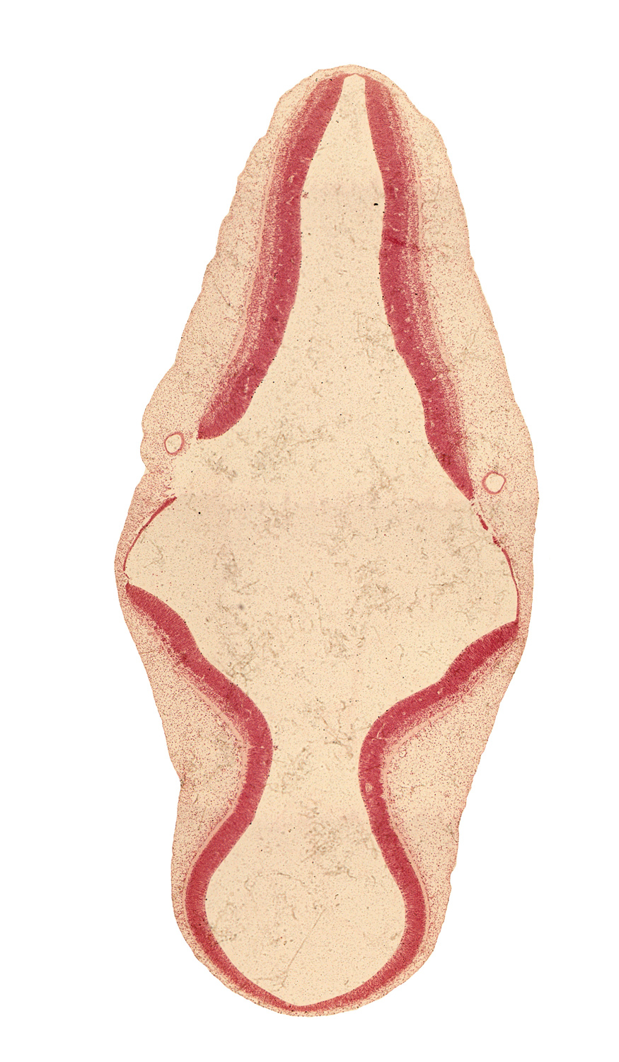 alar plate of metencephalon (cerebellum), alar plate(s), artifact separation(s), basal plate, head mesenchyme, roof plate, sulcus limitans, tectum, tegmentum