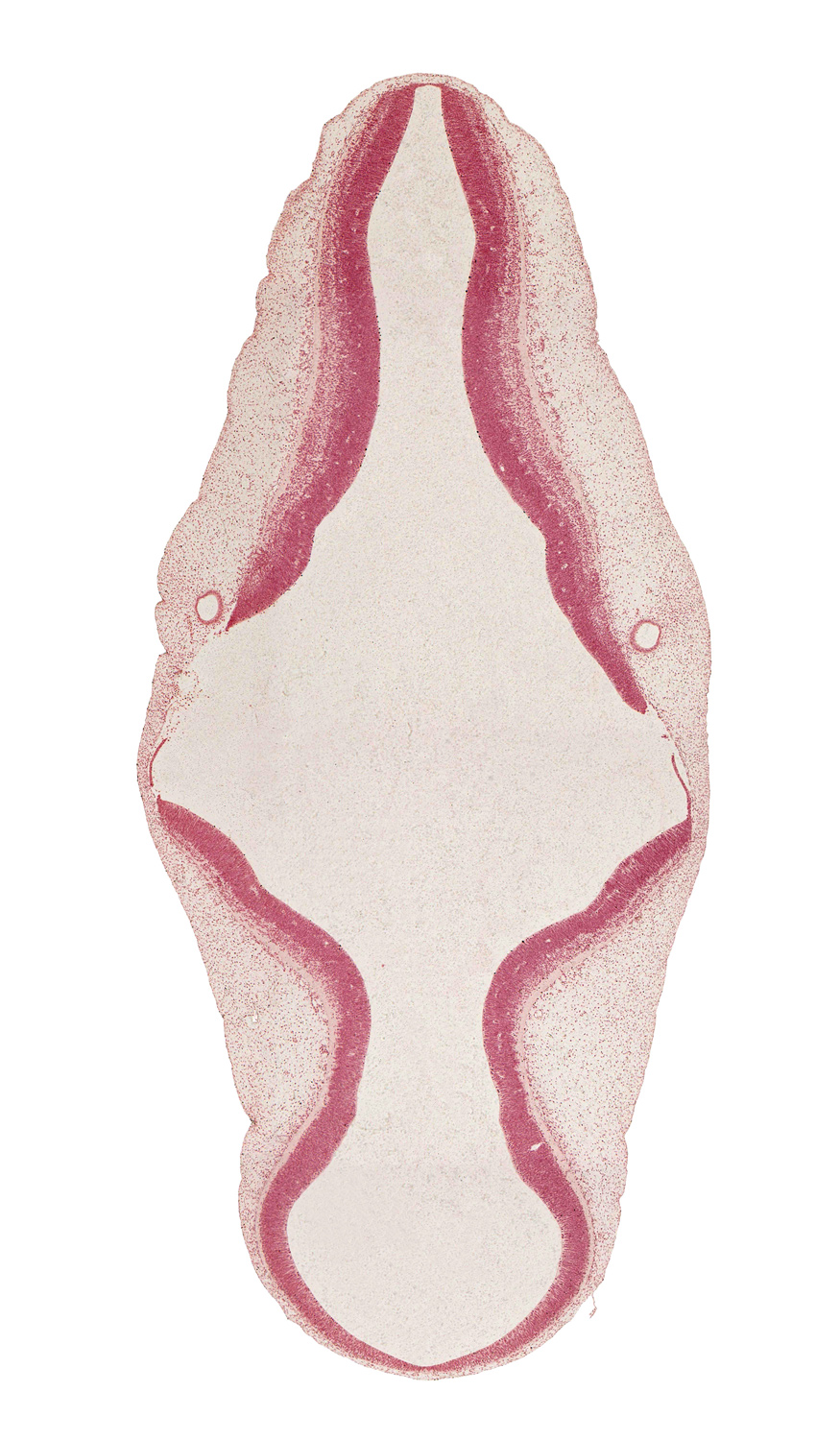 alar plate(s), artifact separation(s), basal plate, isthmus of rhombencephalon, metencephalon, roof plate, sulcus limitans, tectum, tegmentum