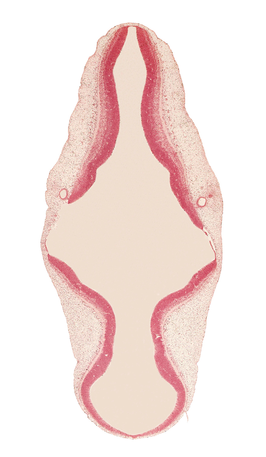 alar plate(s), artifact separation(s), basal plate, cephalic edge of vestibular part of otic vesicle, endolymphatic duct, isthmus of rhombencephalon, mesencoel (cerebral aqueduct), rhombencoel (fourth ventricle), roof plate, sulcus limitans, vascular plexus