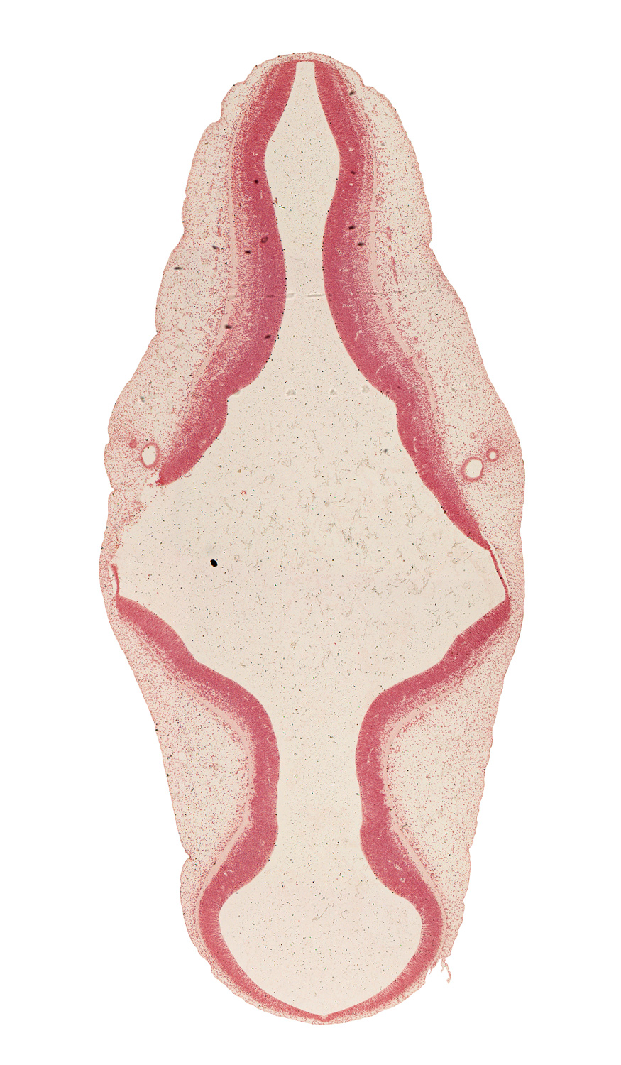 alar plate(s), artifact separation(s), endolymphatic duct, intermediate zone, marginal zone, mesencephalon (M2), metencephalon, myelencephalon, roof plate, sulcus limitans, trochlear nerve (CN IV), ventricular zone, vestibular part of otic vesicle