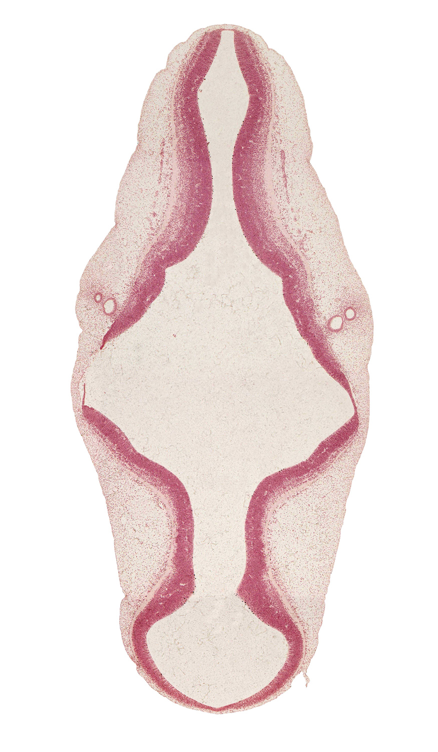 alar plate(s), artifact separation(s), basal plate, cephalic edge of accessory nerve (CN XI), head mesenchyme, isthmus of rhombencephalon, mesencoel (cerebral aqueduct), otic capsule, primordial meninx, rhombencoel (fourth ventricle), roof plate, surface ectoderm, tegmentum