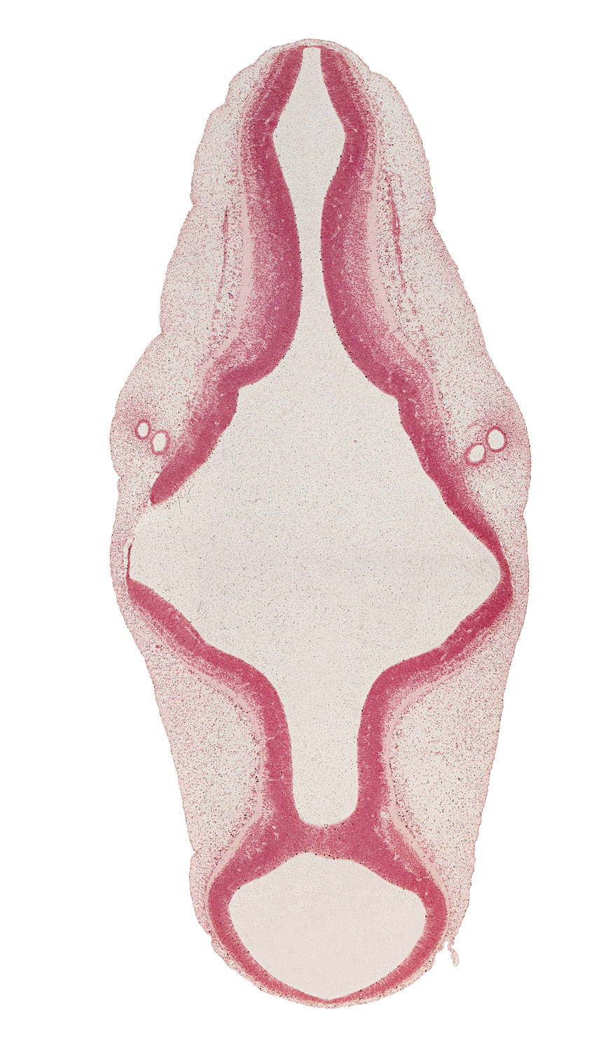 accessory nerve (CN XI), alar plate(s), artifact separation(s), basal plate, endolymphatic duct, intermediate zone, isthmus of rhombencephalon, marginal zone, mesencoel (cerebral aqueduct), rhombencoel (fourth ventricle), roof plate, sulcus limitans, vascular plexus, ventricular zone, vestibular part of otic vesicle