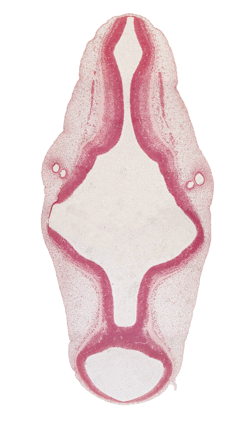 accessory nerve (CN XI), alar plate of metencephalon (cerebellum), alar plate(s), artifact separation(s), basal plate, cephalic edge of vagus nerve (CN X), intermediate zone, isthmus of rhombencephalon, marginal zone, mesencephalon (M2), mesencoel (cerebral aqueduct), metencephalon, myelencephalon, otic capsule, rhombencoel (fourth ventricle), rhombomere 5, rhombomere 6, roof plate, sulcus limitans, trochlear nerve (CN IV), ventricular zone