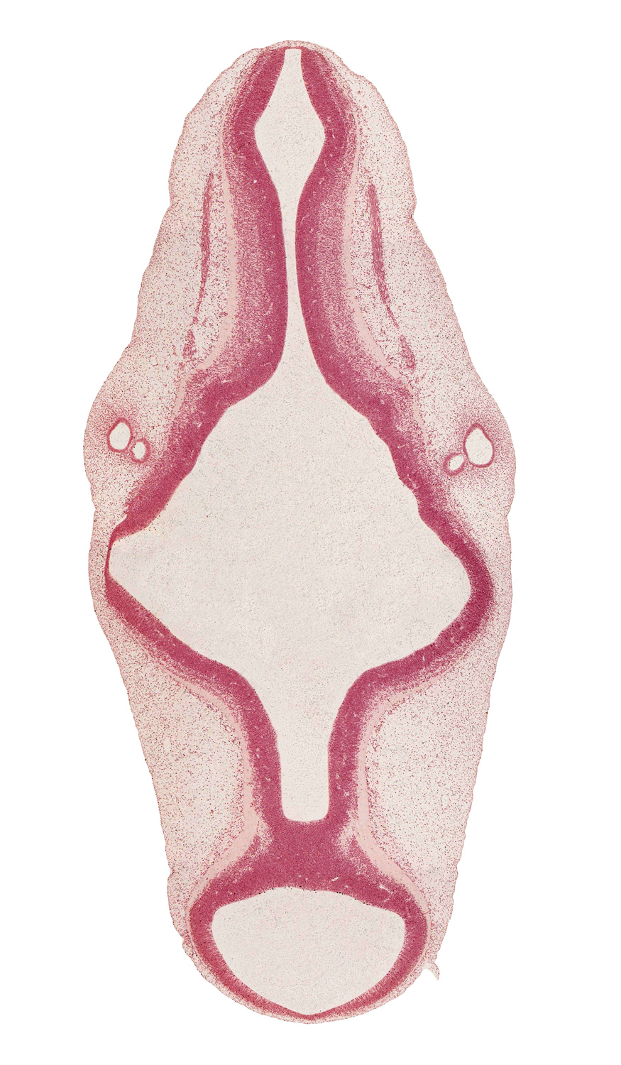 accessory nerve (CN XI), alar plate of metencephalon (cerebellum), alar plate(s), artifact separation(s), basal plate, endolymphatic duct, intermediate zone, marginal zone, mesencoel (cerebral aqueduct), rhombomere 5, rhombomere 6, rhombomere 7, roof plate, roof plate of rhombencephalon, sulcus limitans, vagus nerve (CN X), ventricular zone, vestibular part of otic vesicle