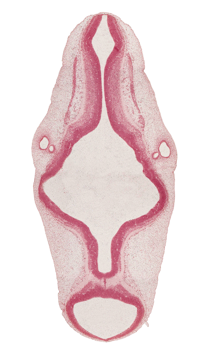 accessory nerve (CN XI), basis pedunculi of pons region (metencephalon), isthmus of rhombencephalon, mesencephalon (M2), metencephalon, myelencephalon, rhombencoel (fourth ventricle), rhombomere 4, rhombomere 5, rhombomere 6, rhombomere 7, roof plate, roof plate of rhombencephalon, sulcus limitans, tectum, tegmentum, vascular plexus