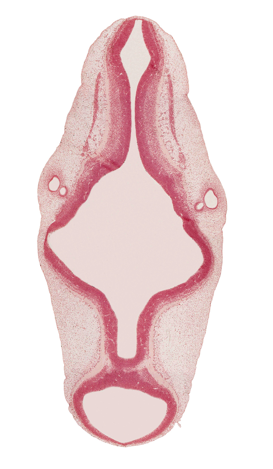 accessory nerve (CN XI), artifact separation(s), central canal of myelencephalon, endolymphatic duct, intermediate zone, junction of central canal and rhombencoel (fourth ventricle), marginal zone, mesencoel (cerebral aqueduct), otic capsule, rhombencoel (fourth ventricle), rhombomere 4, rhombomere 5, rhombomere 6, rhombomere 7, sulcus limitans, ventricular zone