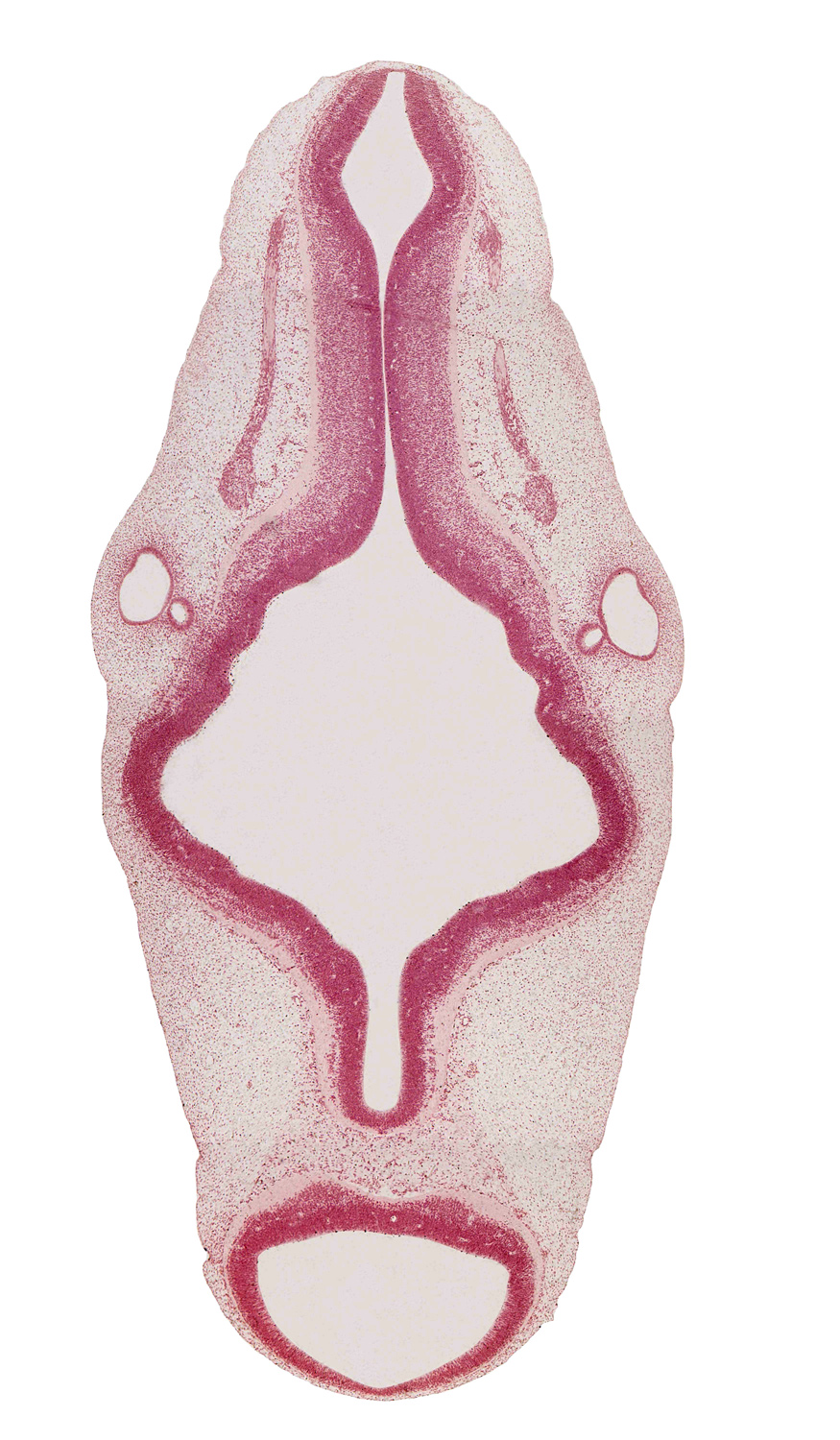 accessory nerve (CN XI), alar plate(s), basal plate, endolymphatic duct, isthmus of rhombencephalon, mesencephalon, otic capsule, region of mesencephalic (cephalic) flexure, rhombomere 4, rhombomere 5, rhombomere 6, roof plate, semicircular groove, sulcus limitans, tectum, tegmentum, trochlear nerve (CN IV), vestibular part of otic vesicle