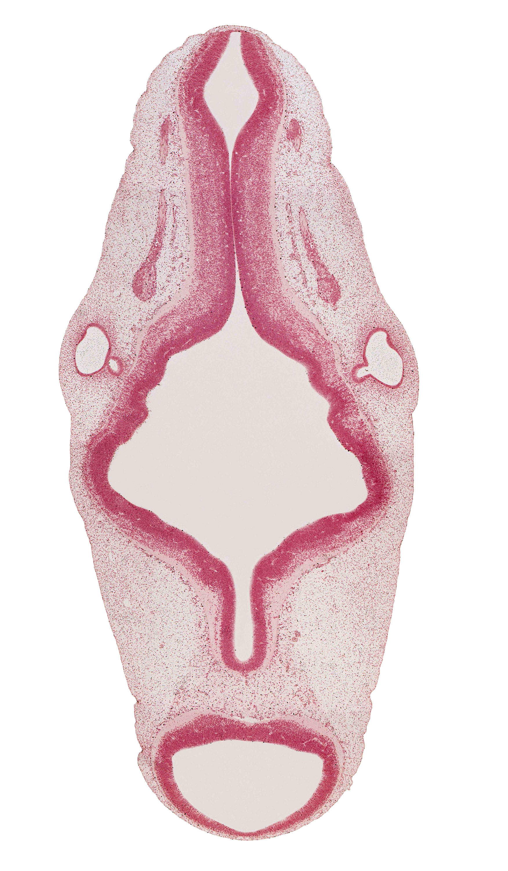 accessory nerve (CN XI), alar plate(s), basal plate, intermediate zone, junction of endolymphatic duct and vestibular part of otic vesicle, marginal zone, median sulcus, mesencephalon, rhombomere 2, rhombomere 5, rhombomere 6, roof plate of myelencephalon, root of oculomotor nerve (CN III), semicircular groove, sulcus limitans, trochlear nerve (CN IV), vagus nerve (CN X), vascular plexus, ventricular zone