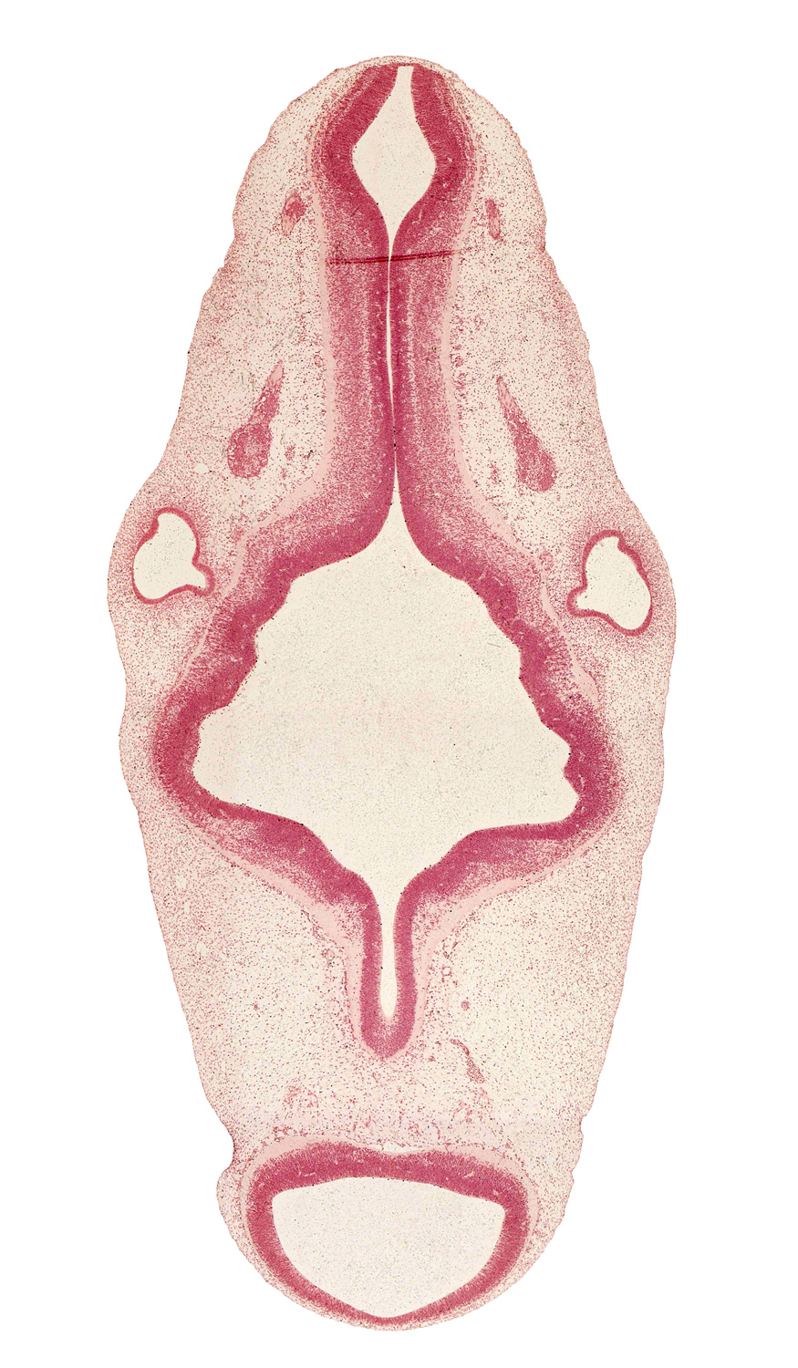 accessory nerve (CN XI), basal plate, central canal of myelencephalon, intermediate zone, marginal zone, median sulcus, mesencephalon (M1), oculomotor nerve (CN III), rhombomere 2, rhombomere 3, rhombomere 4, rhombomere 5, rhombomere 6, root of glossopharyngeal nerve (CN IX), sulcus limitans, superior ganglion of vagus nerve (CN X), trochlear nerve (CN IV), ventricular zone