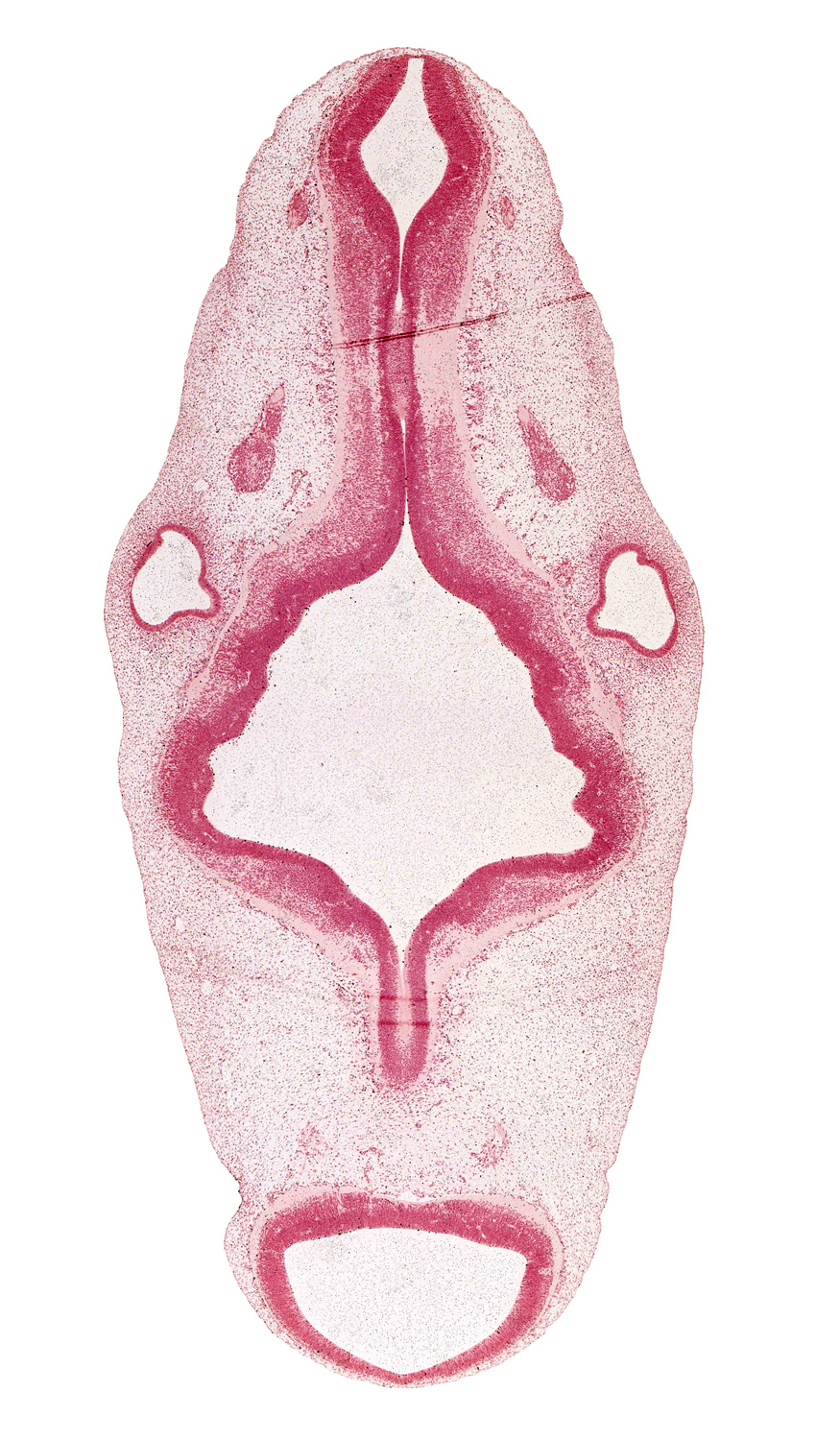 accessory nerve (CN XI), central canal of myelencephalon, glossopharyngeal nerve (CN IX), median sulcus, mesencoel (cerebral aqueduct), oculomotor nerve (CN III), otic capsule condensation, primordial meninx, region of mesencephalic (cephalic) flexure, rhombencoel (fourth ventricle), rhombomere 2, rhombomere 3, rhombomere 4, rhombomere 5, rhombomere 6, root of hypoglossal nerve (CN XII), semicircular groove, trochlear nerve (CN IV), vagus nerve (CN X), vestibular part of otic vesicle