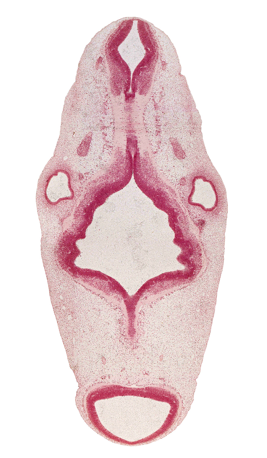 central canal, intermediate zone, marginal zone, median sulcus, mesencoel (cerebral aqueduct), myelencephalon, region of mesencephalic (cephalic) flexure, rhombencoel (fourth ventricle), rhombomere 2, rhombomere 3, rhombomere 4, rhombomere 5, rhombomere 6, root of facial nerve (CN VII), root of hypoglossal nerve (CN XII), root of vestibulocochlear nerve (CN VIII), sulcus limitans, tectum, tegmentum, trochlear nerve (CN IV), ventricular zone