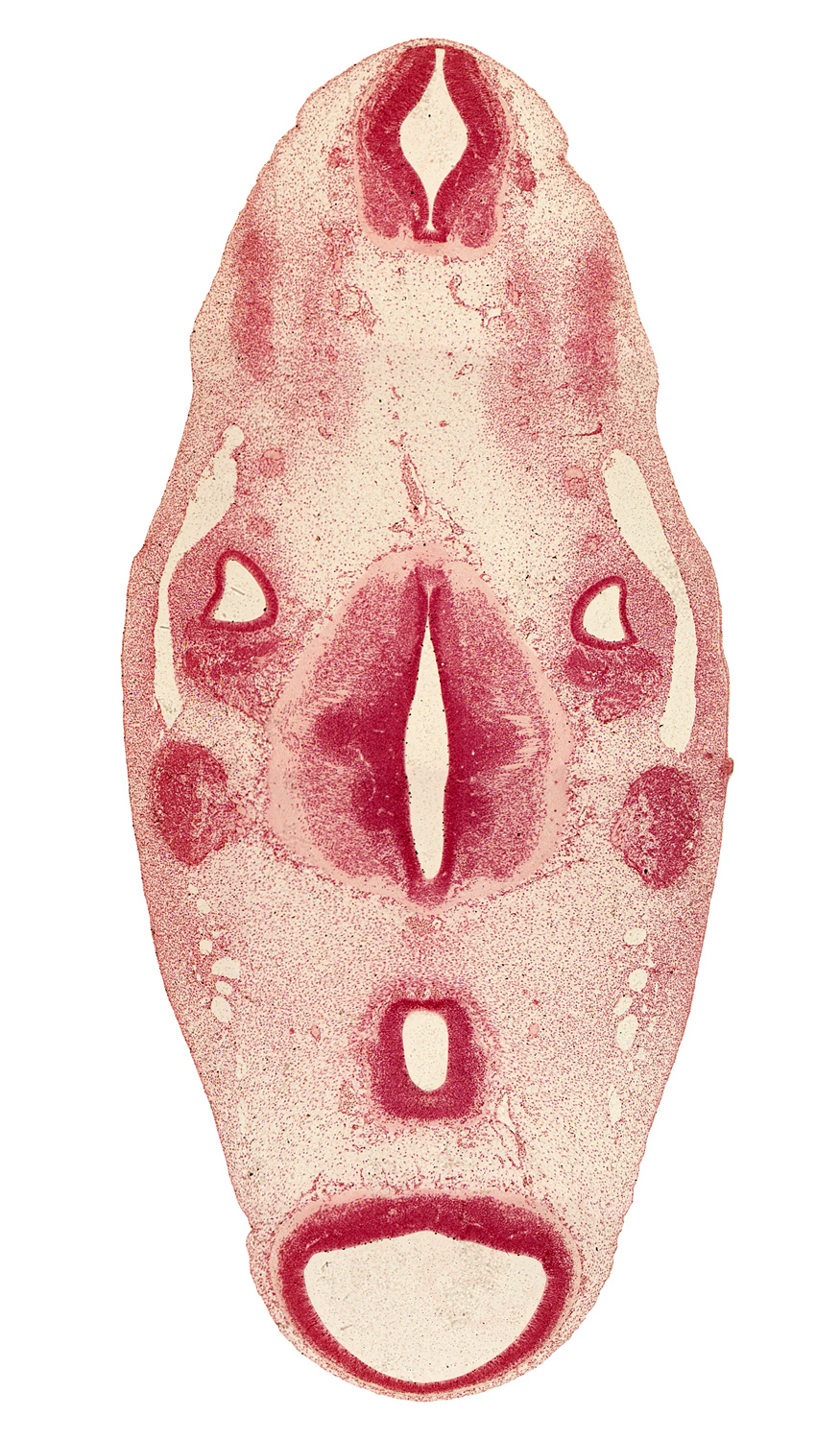 accessory nerve (CN XI), alar plate(s), anterior dural venous plexus, basal plate, cerebral peduncle, cochlear ganglion (CN VIII), cochlear part of otic vesicle, diencephalon, floor plate, glossopharyngeal nerve (CN IX), intermediate zone, marginal zone, median sulcus, mesencoel (cerebral aqueduct), oculomotor nerve (CN III), primary head vein, rhombomere 4, roof plate, root of hypoglossal nerve (CN XII), sulcus limitans, tectum, tegmentum, trigeminal ganglion (CN V), trochlear nerve (CN IV), ventricular zone