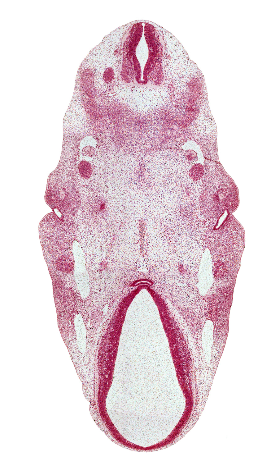 C-1 / C-2 interganglion region, adenohypophysial pouch, anterior dural venous plexus, basilar artery, central canal, cephalic edge of pharynx, dorsal sulcus, dorsal thalamus, epithalamus, facial nerve (CN VII), hypoglossal nerve (CN XII), inferior ganglion of glossopharyngeal nerve (CN IX), intermediate zone, internal carotid artery, mandibular nerve (CN V₃), marginal zone, maxillary nerve (CN V₂), maxillary vein, mesenchyme of pharyngeal arch 2, middle sulcus, neurohypophyseal bud, notochord, ophthalmic nerve (CN V₁), pharyngeal pouch 1, precardinal vein, roof plate, root of hypoglossal nerve (CN XII), ventral (hypothalamic) sulcus, ventral root, ventricular zone