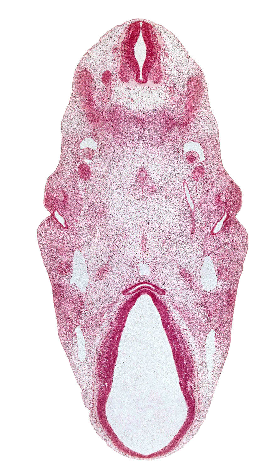 C-1 / C-2 interganglion region, cephalic end of notochord, dorsal fasciculus, dorsal sulcus, dorsal thalamus, extra-ocular premuscle mass, facial nerve (CN VII), hypoglossal nerve (CN XII), hypothalamus, inferior ganglion of vagus nerve (CN X), internal carotid artery, lateral rectus premuscle mass, mandibular nerve (CN V₃), maxillary nerve (CN V₂), maxillary vein, mesenchyme of pharyngeal arch 2, middle sulcus, myotome, pharyngeal groove 1, pharyngeal pouch 1, precardinal vein, primordial meninx, roof of pharynx, roof plate, sclerotome, sympathetic trunk, third ventricle, ventral (hypothalamic) sulcus, ventral thalamus